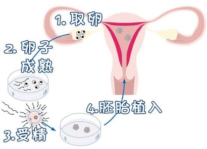 关于试管供卵公司